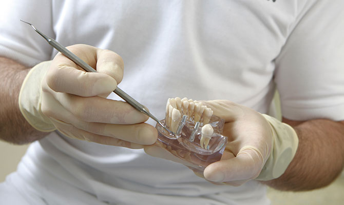 zahnarzt mit zahnimplantate in der hand